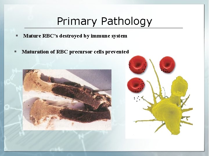 Primary Pathology § Mature RBC’s destroyed by immune system § Maturation of RBC precursor