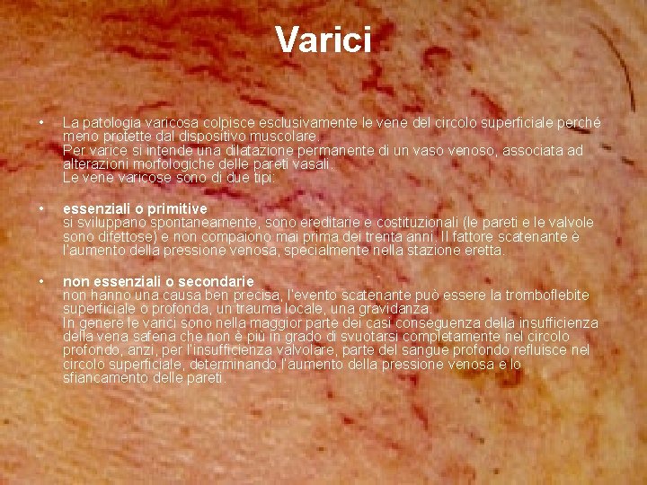 Varici • La patologia varicosa colpisce esclusivamente le vene del circolo superficiale perché meno Varici • La patologia varicosa colpisce esclusivamente le vene del circolo superficiale perché meno