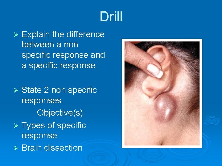 Drill Ø Explain the difference between a non specific response and a specific response.