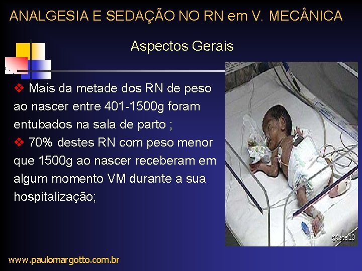 ANALGESIA E SEDAÇÃO NO RN em V. MEC NICA Aspectos Gerais v Mais da