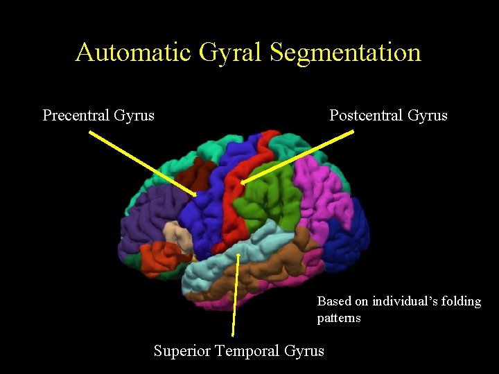 Automatic Gyral Segmentation Precentral Gyrus Postcentral Gyrus Based on individual’s folding patterns Superior Temporal