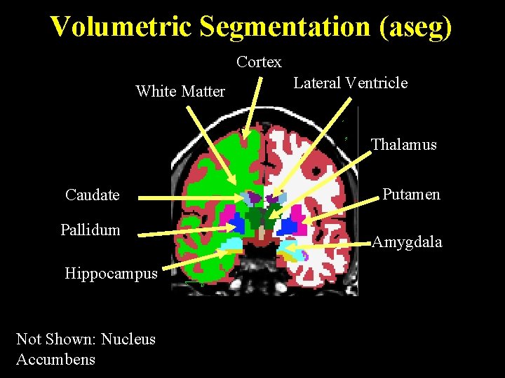 Volumetric Segmentation (aseg) Cortex White Matter Lateral Ventricle Thalamus Caudate Pallidum Hippocampus Not Shown: