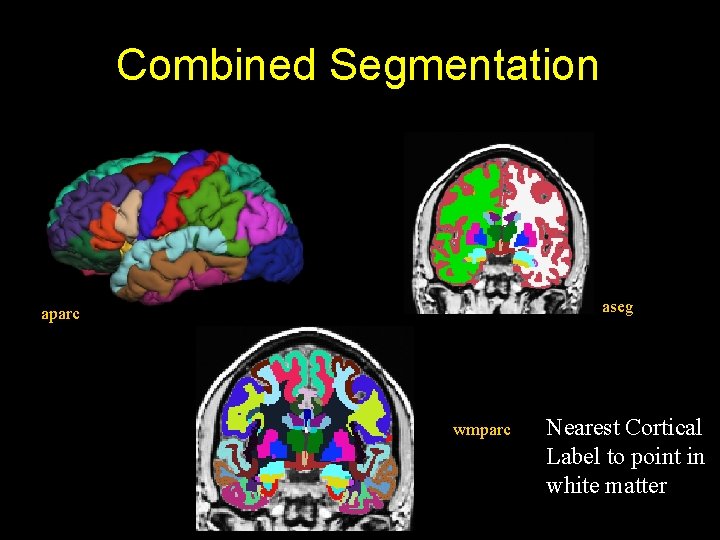 Combined Segmentation aseg aparc wmparc Nearest Cortical Label to point in white matter 
