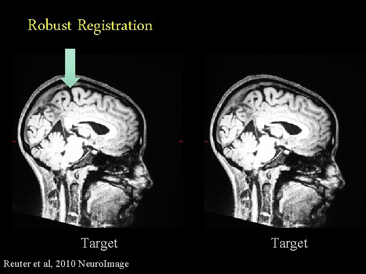 Robust Registration Target Reuter et al, 2010 Neuro. Image Target 