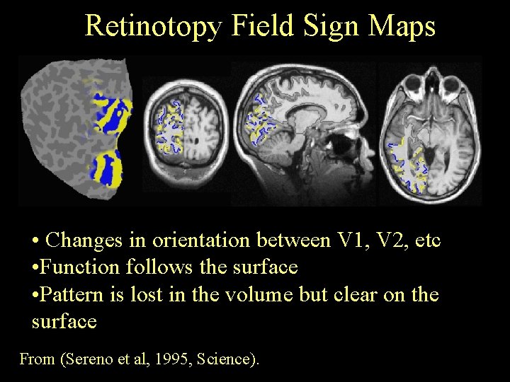 Retinotopy Field Sign Maps • Changes in orientation between V 1, V 2, etc