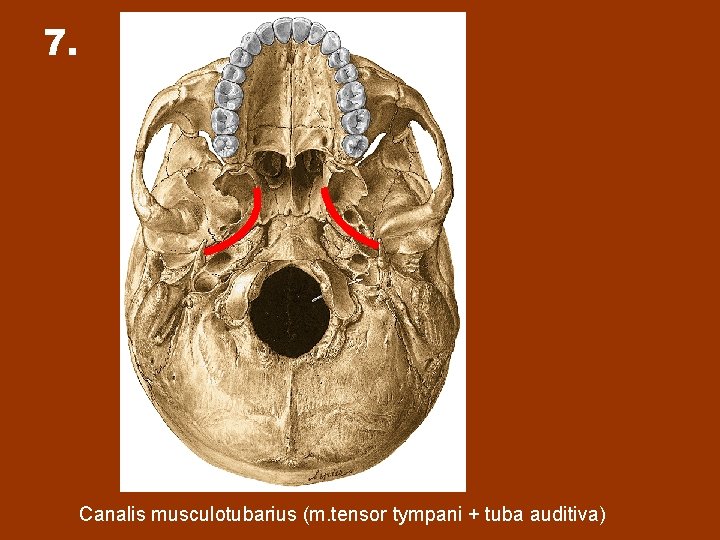 7. Canalis musculotubarius (m. tensor tympani + tuba auditiva) 