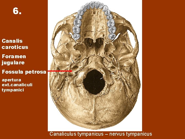 6. Canalis caroticus Foramen jugulare Fossula petrosa apertura ext. canaliculi tympanici Canaliculus tympanicus –