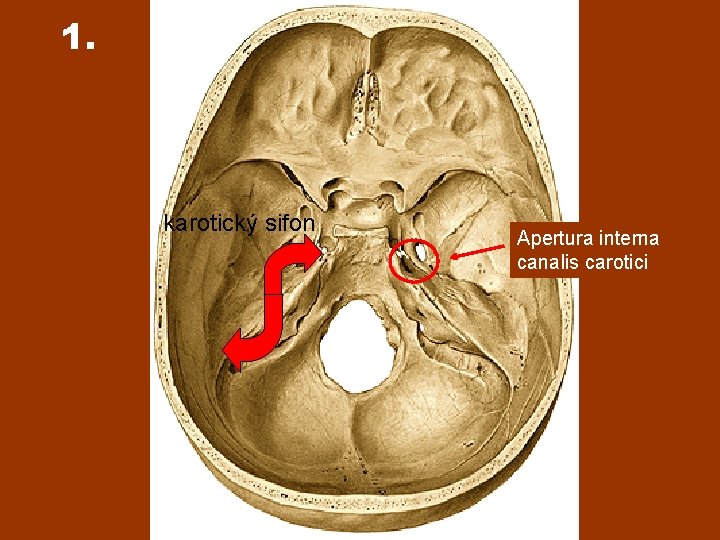 1. karotický sifon Apertura interna canalis carotici 