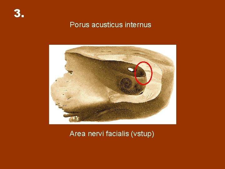 3. Porus acusticus internus Area nervi facialis (vstup) 