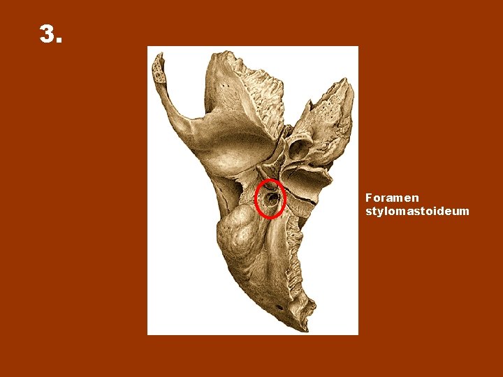 3. Foramen stylomastoideum 