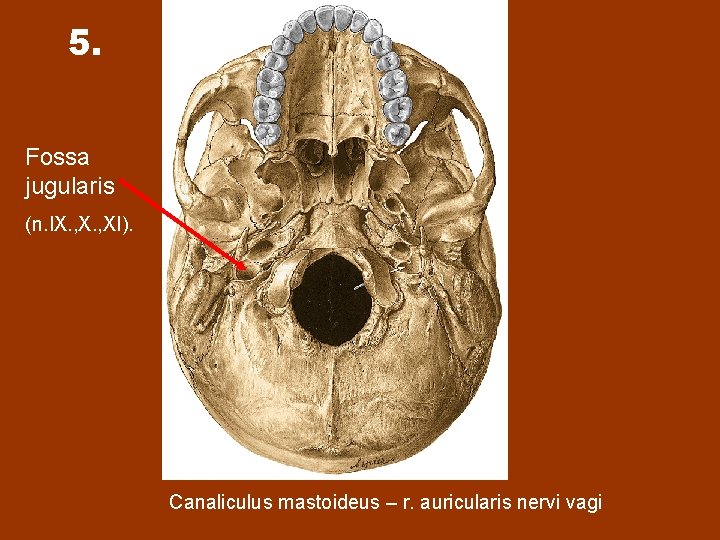 5. Fossa jugularis (n. IX. , XI). Canaliculus mastoideus – r. auricularis nervi vagi
