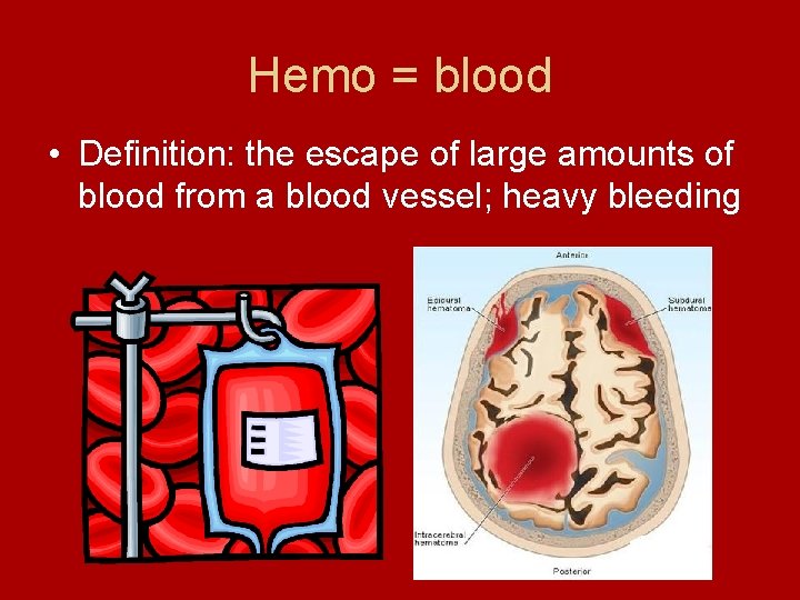 Hemo = blood • Definition: the escape of large amounts of blood from a Hemo = blood • Definition: the escape of large amounts of blood from a