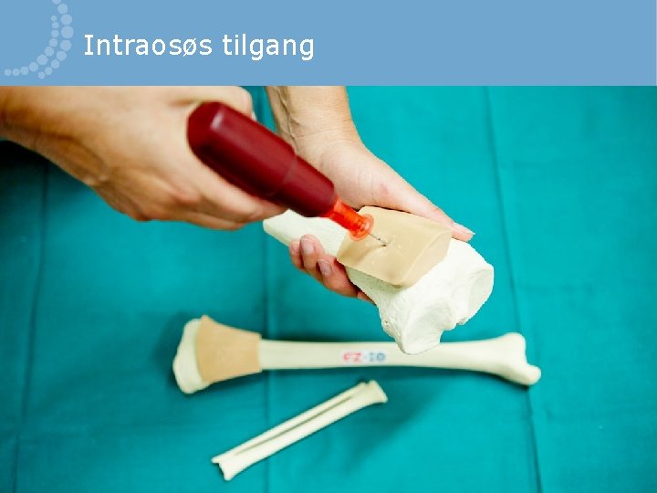 Intraosøs tilgang 