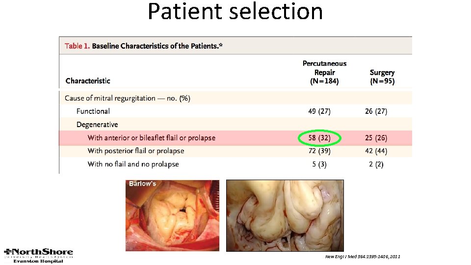 Patient selection New Engl J Med 364: 1395 -1406, 2011 