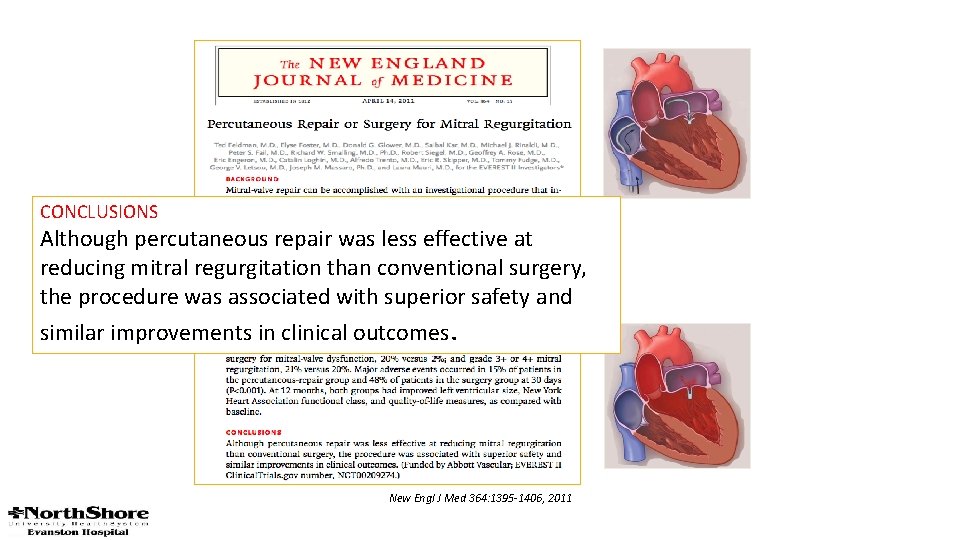 CONCLUSIONS Although percutaneous repair was less effective at reducing mitral regurgitation than conventional surgery,