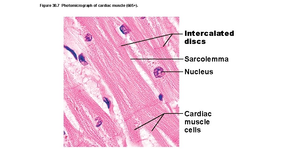 Figure 30. 7 Photomicrograph of cardiac muscle (665×). Intercalated discs Sarcolemma Nucleus Cardiac muscle