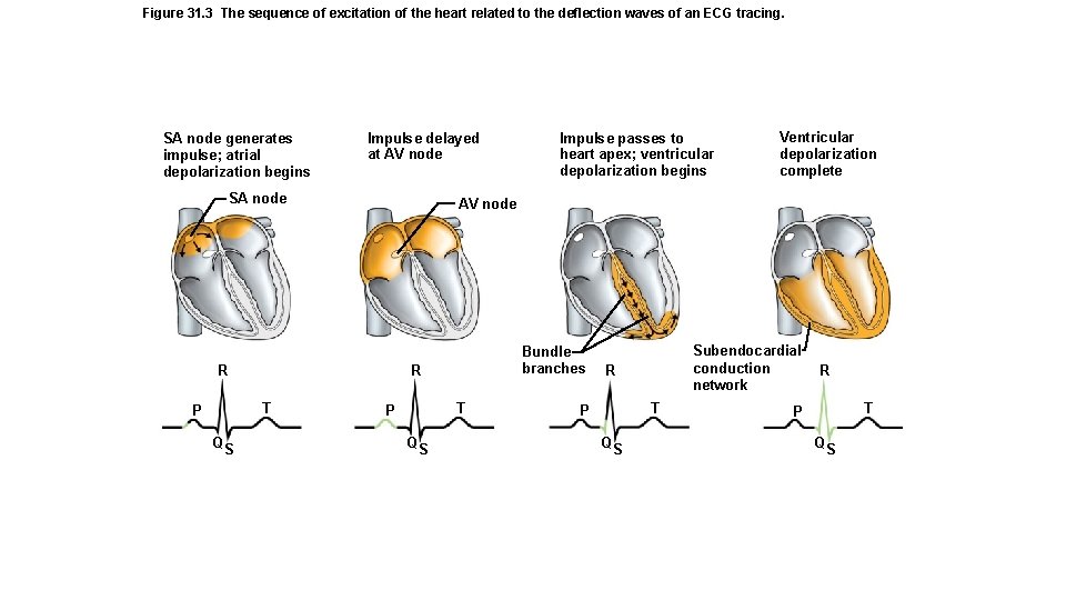 Figure 31. 3 The sequence of excitation of the heart related to the deflection