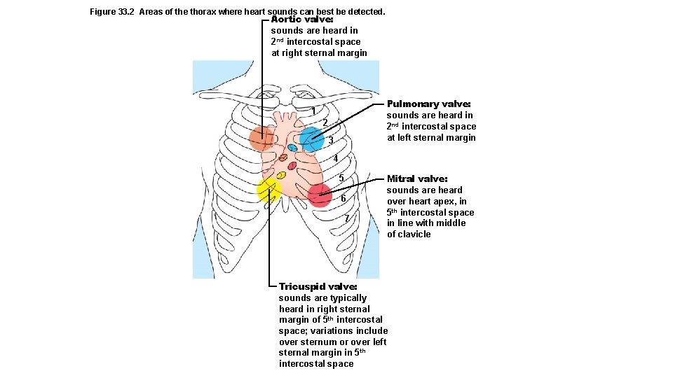 Figure 33. 2 Areas of the thorax where heart sounds can best be detected.