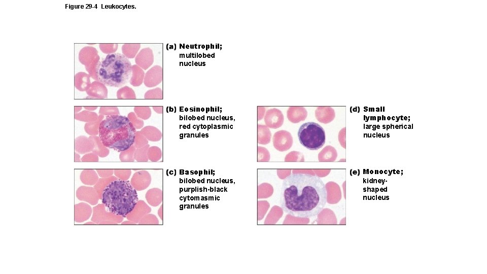 Figure 29 -4 Leukocytes. Neutrophil; multilobed nucleus Eosinophil; bilobed nucleus, red cytoplasmic granules Small