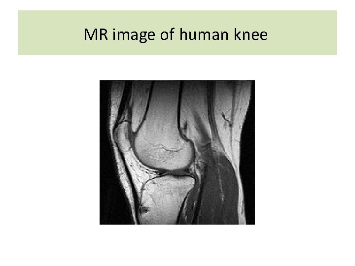  MR image of human knee 