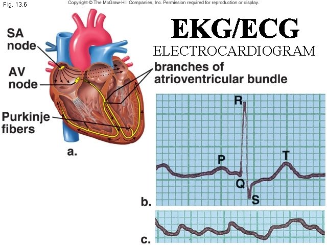 Fig. 13. 6 ELECTROCARDIOGRAM 