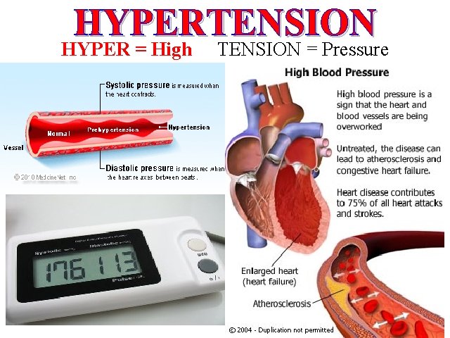 HYPERTENSION HYPER = High TENSION = Pressure 