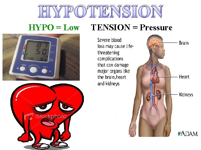 HYPOTENSION HYPO = Low TENSION = Pressure 
