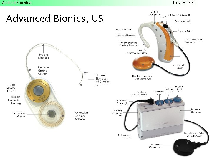 Artificial Cochlea Advanced Bionics, US Jong-Mo Seo 