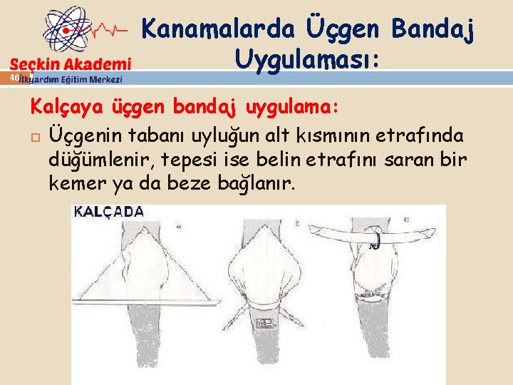 46 Kanamalarda Üçgen Bandaj Uygulaması: Kalçaya üçgen bandaj uygulama: Üçgenin tabanı uyluğun alt kısmının