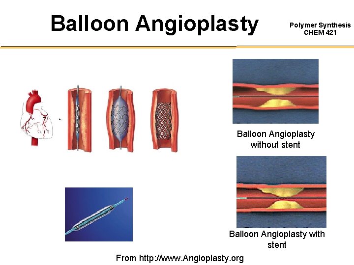 Balloon Angioplasty Polymer Synthesis CHEM 421 Balloon Angioplasty without stent Balloon Angioplasty with stent