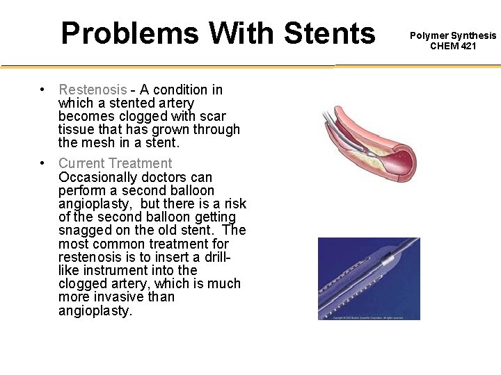 Problems With Stents • Restenosis - A condition in which a stented artery becomes