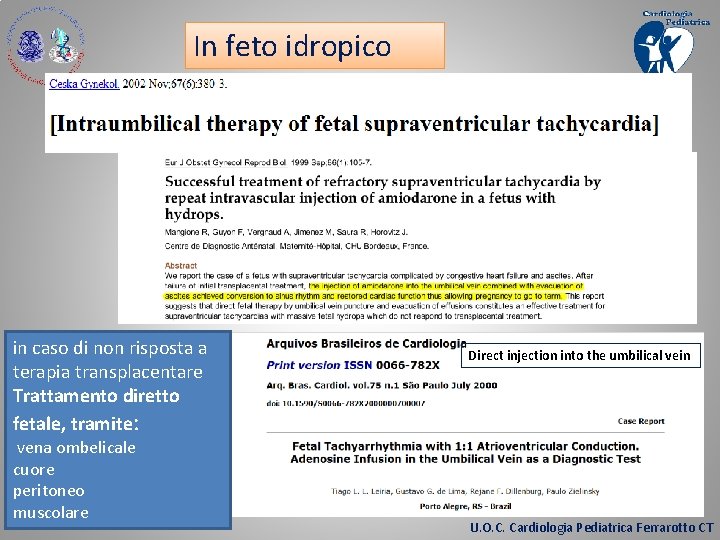 In feto idropico in caso di non risposta a terapia transplacentare Trattamento diretto fetale,