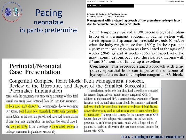 Pacing neonatale in parto pretermine U. O. C. Cardiologia Pediatrica Ferrarotto CT 