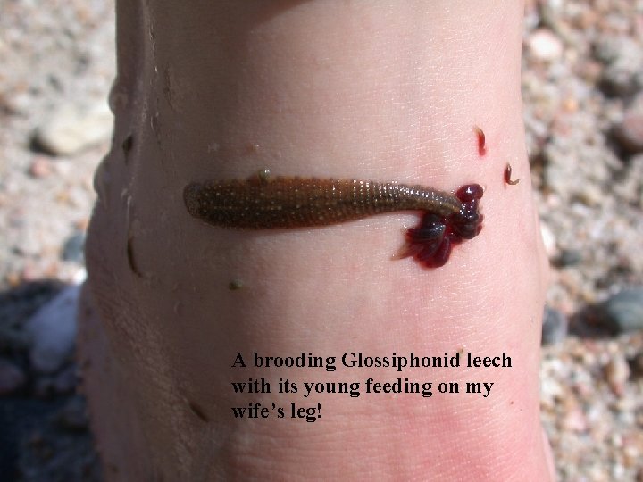 A brooding Glossiphonid leech with its young feeding on my wife’s leg! 