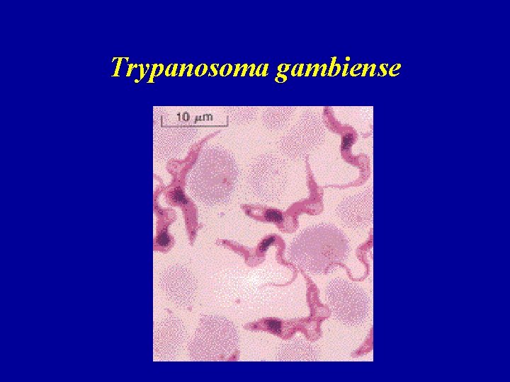 Trypanosoma gambiense 