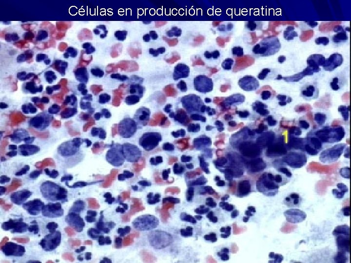 Células en producción de queratina 