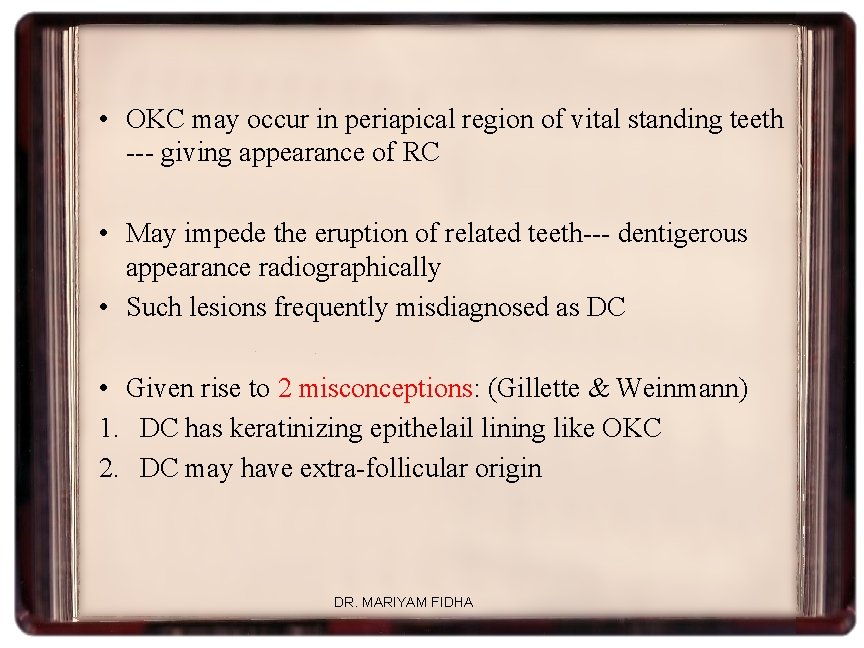  • OKC may occur in periapical region of vital standing teeth --- giving