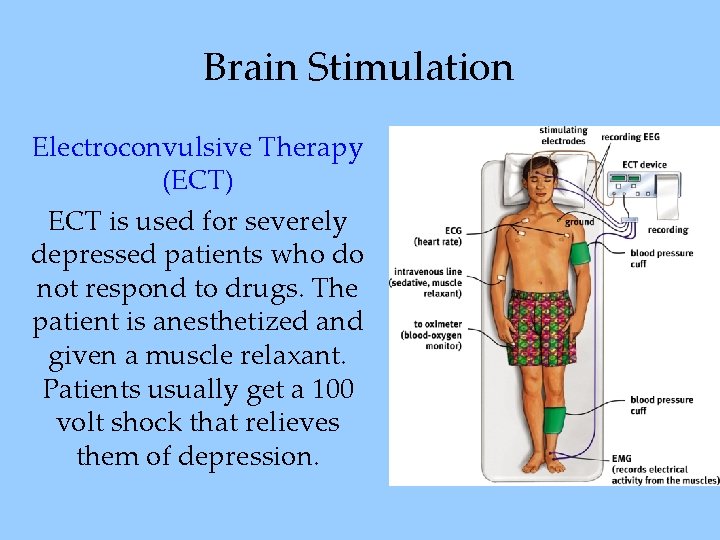 Brain Stimulation Electroconvulsive Therapy (ECT) ECT is used for severely depressed patients who do