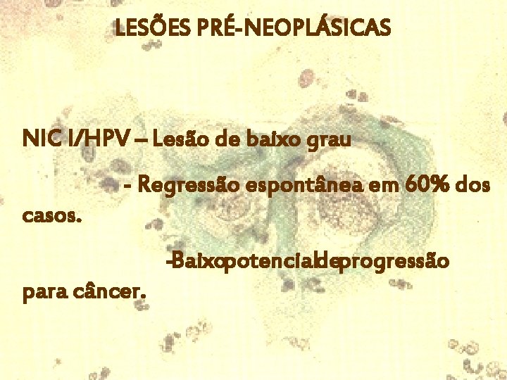 LESÕES PRÉ-NEOPLÁSICAS NIC I/HPV – Lesão de baixo grau - Regressão espontânea em 60%