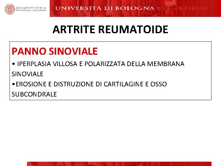 ARTRITE REUMATOIDE PANNO SINOVIALE • IPERPLASIA VILLOSA E POLARIZZATA DELLA MEMBRANA SINOVIALE • EROSIONE ARTRITE REUMATOIDE PANNO SINOVIALE • IPERPLASIA VILLOSA E POLARIZZATA DELLA MEMBRANA SINOVIALE • EROSIONE