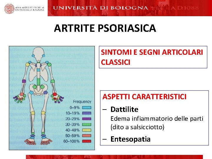ARTRITE PSORIASICA SINTOMI E SEGNI ARTICOLARI CLASSICI ASPETTI CARATTERISTICI – Dattilite Edema infiammatorio delle ARTRITE PSORIASICA SINTOMI E SEGNI ARTICOLARI CLASSICI ASPETTI CARATTERISTICI – Dattilite Edema infiammatorio delle