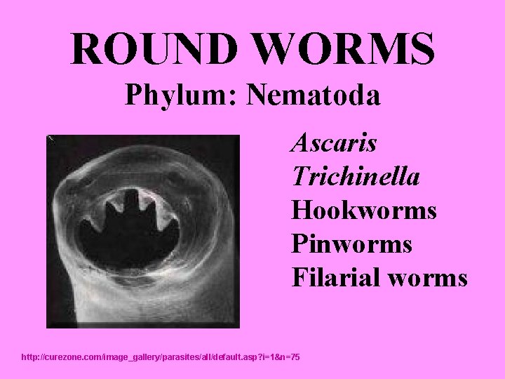 Trichinella pinworms)