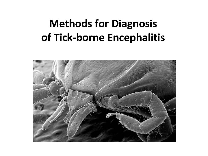 Methods for Diagnosis of Tick-borne Encephalitis 