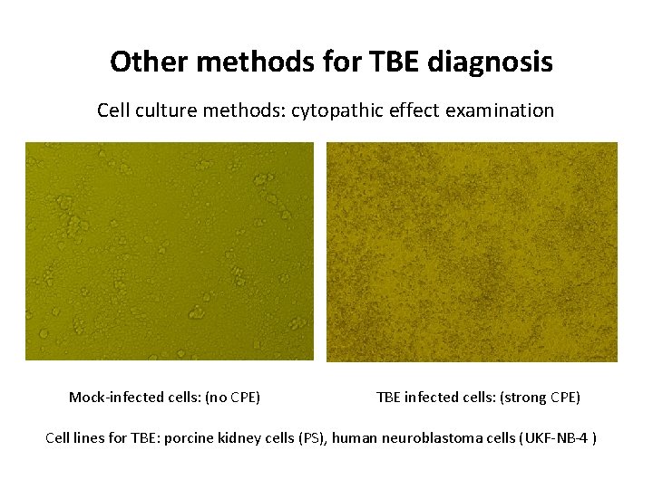 Other methods for TBE diagnosis Cell culture methods: cytopathic effect examination Mock-infected cells: (no