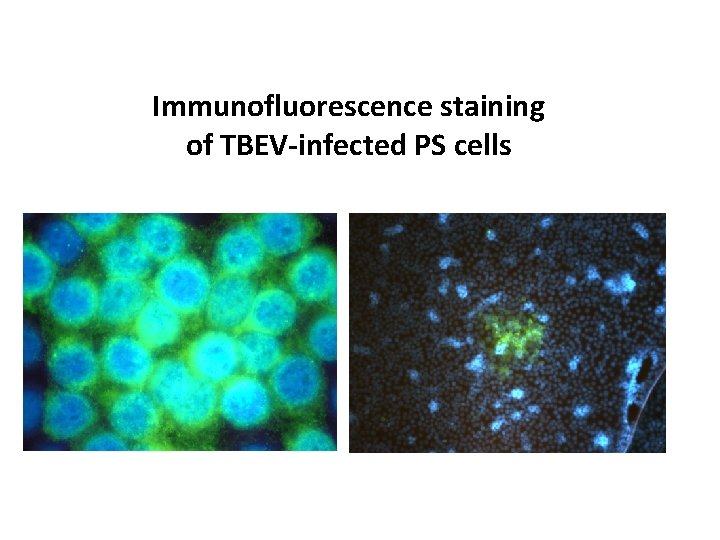 Immunofluorescence staining of TBEV-infected PS cells 