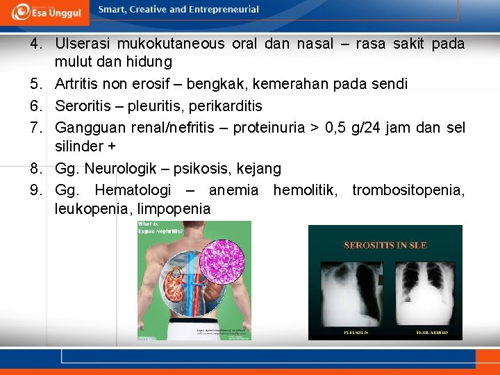 4. Ulserasi mukokutaneous oral dan nasal – rasa sakit pada mulut dan hidung 5.