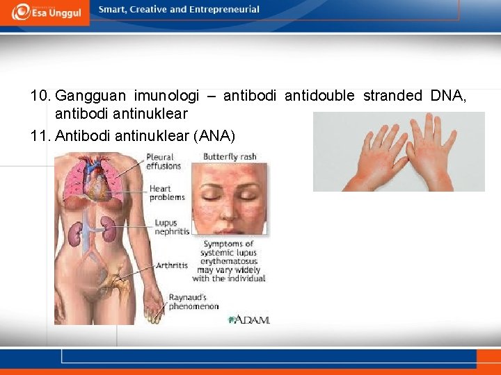 10. Gangguan imunologi – antibodi antidouble stranded DNA, antibodi antinuklear 11. Antibodi antinuklear (ANA)