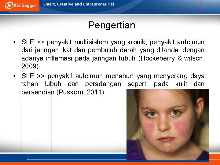 Pengertian • SLE >> penyakit multisistem yang kronik, penyakit autoimun dari jaringan ikat dan