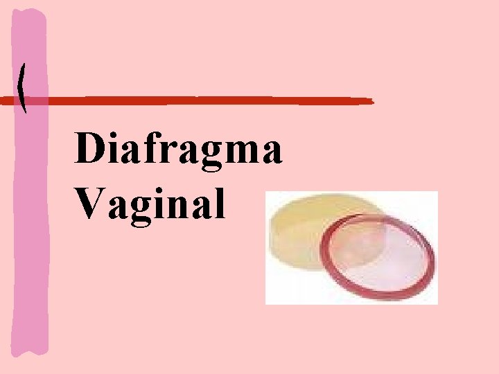 Diafragma Vaginal 