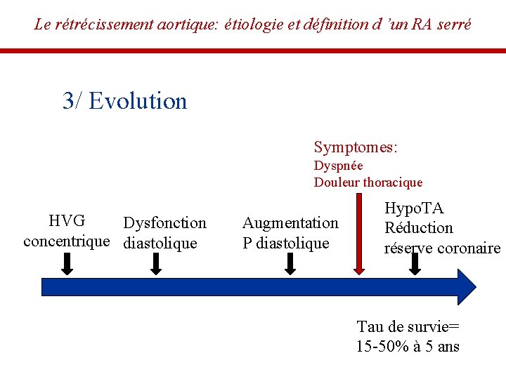 Le rétrécissement aortique: étiologie et définition d ’un RA serré 3/ Evolution Symptomes: Dyspnée